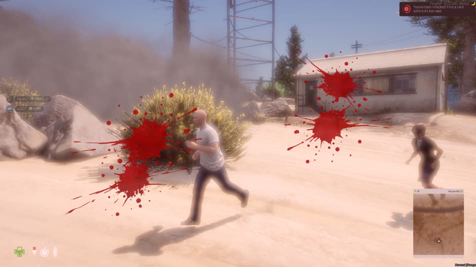 [PAID] 🧟 RZR Zombie Core ( QBCore | QBX | ESX | OX | CUSTOM FRAMEWORK ) thumbnail 3